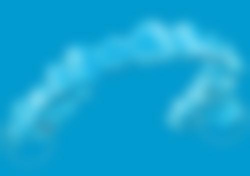 洗牙的注意事项