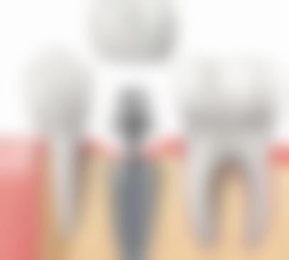 四、南宁恺泽恺贝口腔特色项目