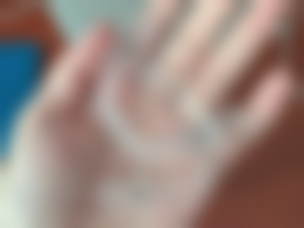 牙齿缺失必须种植牙吗？其实并非如此，多种修复方案可选，需依情况和医生建议定！ 