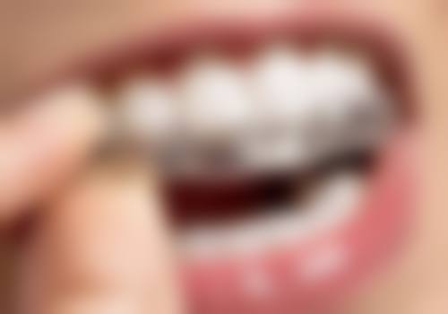 八、湘潭玉笑口腔门诊部怎么预约？