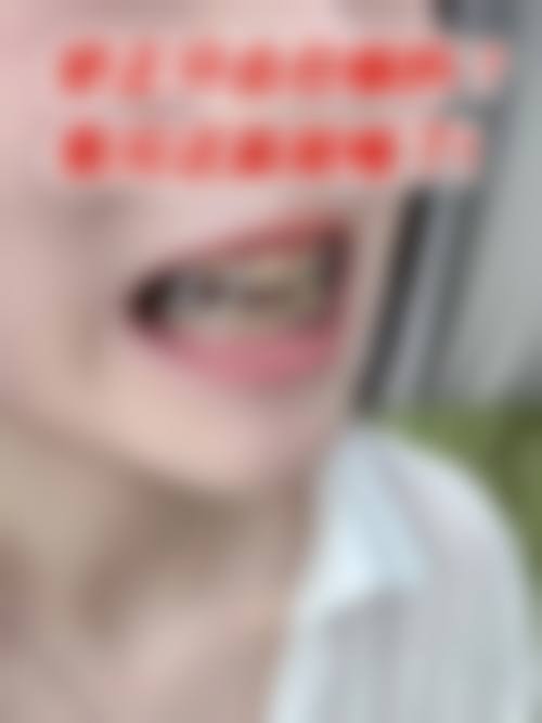 四、北京青苗口腔门诊部特色项目