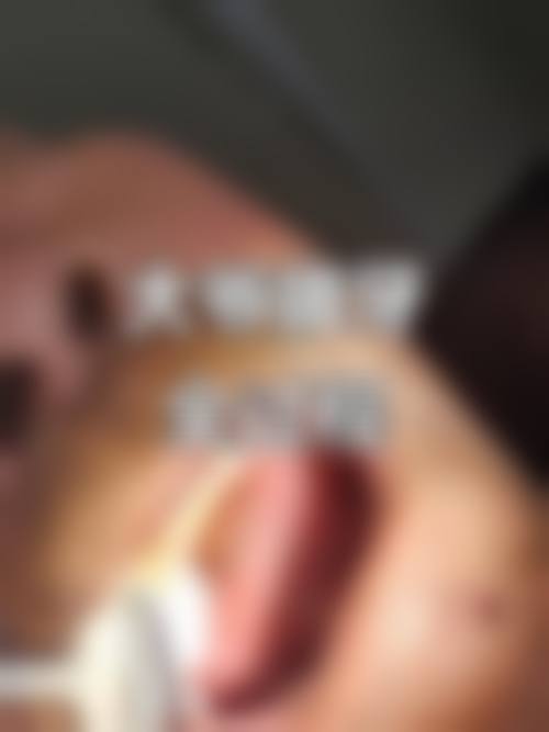 五、国内科学 院大学深圳医院口腔科收费价格表