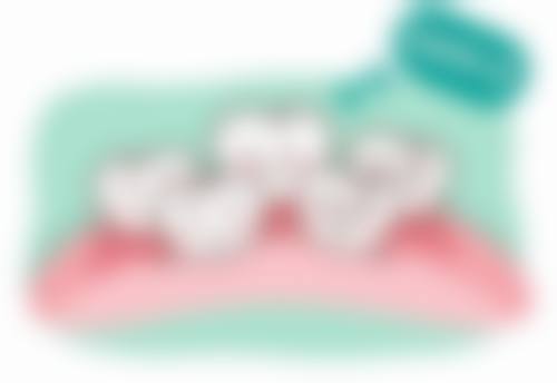 小孩子地包天的矫正方法