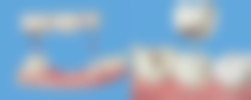 五、湖州钟永泉口腔收费价格表