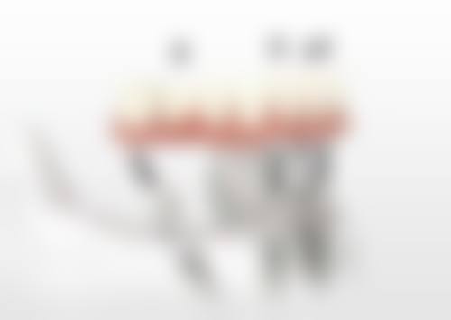 五、渭南杨涛口腔收费价格表