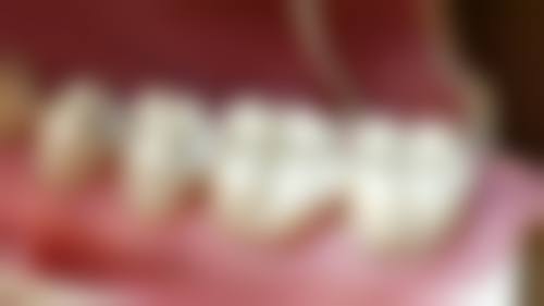 八、渭南杨涛口腔怎么预约?