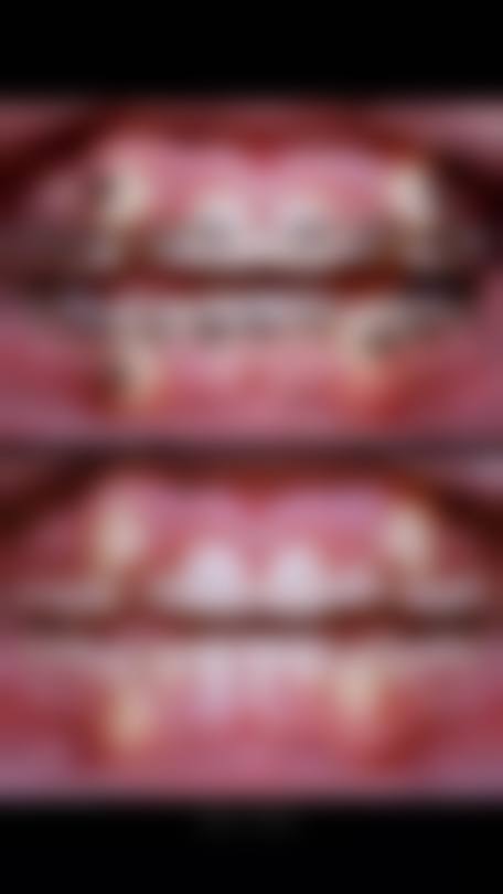 四、安徽蚌埠周治国口腔特色项目