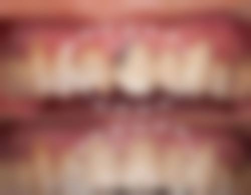 四、杭州创立街口腔门诊部特色项目