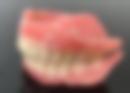 普通拔牙的影响