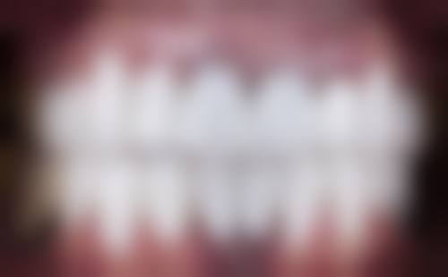 五、重庆爱思特医院口腔科收费价格表