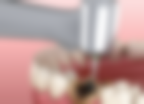 四、镇江三好口腔诊所特色项目