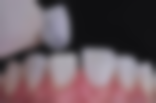 冯国周医生成功实例分享