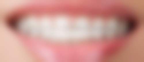 登腾1980首颗——患者实例