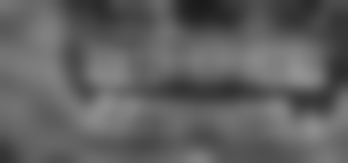 四、满洲里雅美口腔门诊部特色项目