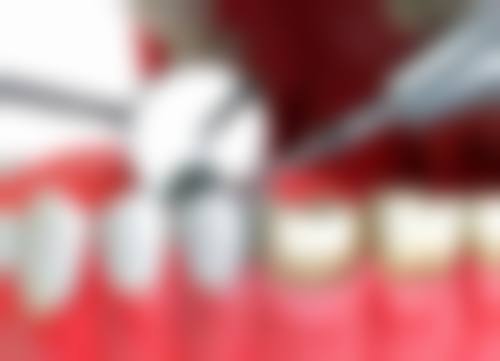 六、广东珠海圣贝口腔口碑如何？