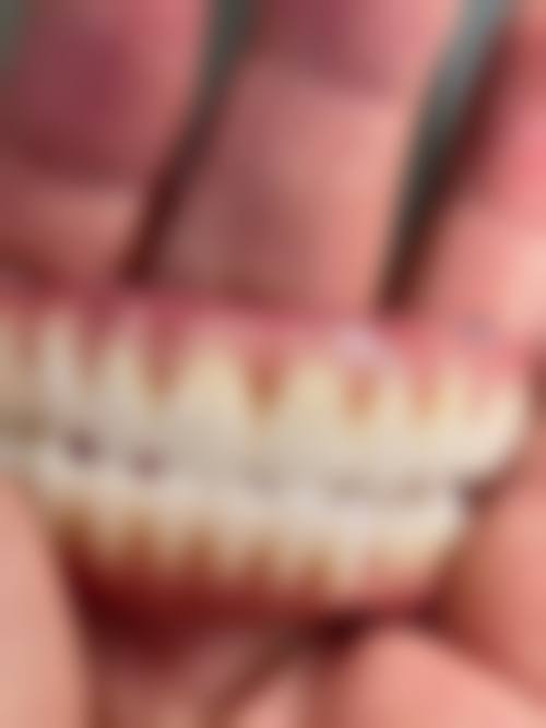 四、温州瑞安叶阿波口腔特色项目