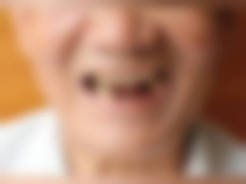 四、深圳维港口腔(欢笑店)特色项目