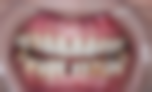 四、吉安尚品口腔（影城院）特色项目