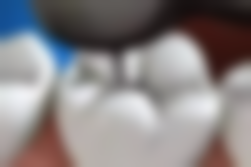 五、吉安尚品口腔（影城院）收费价格表