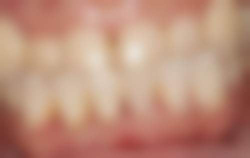 五、景德镇乐平冯治坪口腔门诊部收费价格表