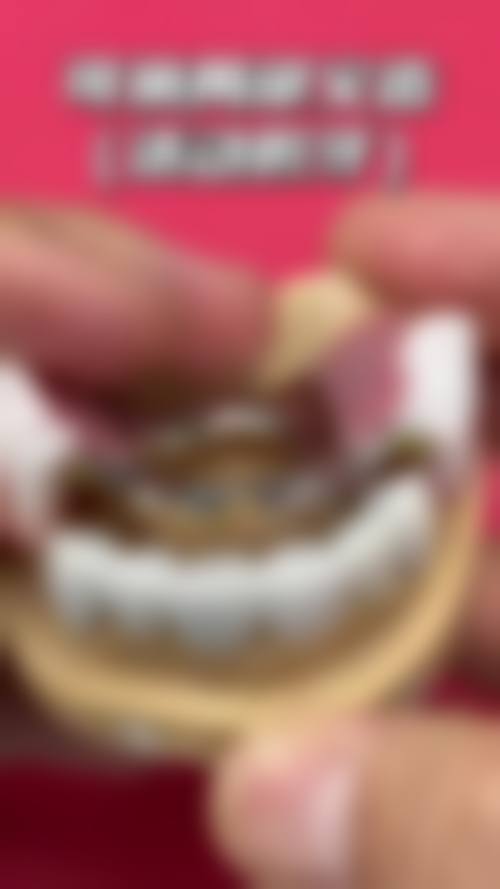 四、宜昌宜都黄志强口腔诊所特色项目