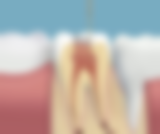 五、山东威海乳山胡书杰口腔收费价格表