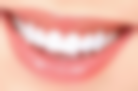 洗牙器可以洗掉牙石吗？一般不能完全洗掉，但能去除部分，彻底清除还得靠专业洗牙！ 