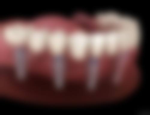 五、郑州未来口腔旗舰店收费价格表