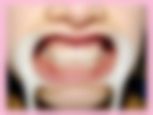 四、永州贝美口腔门诊部特色项目