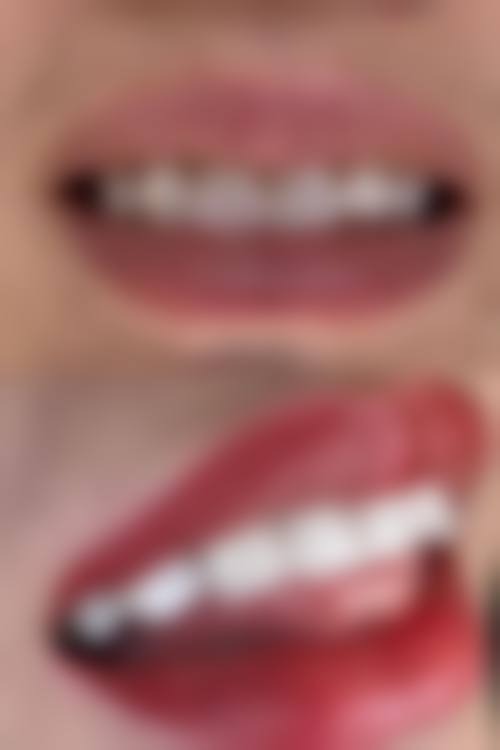 五、泰安焕新口腔收费价格表