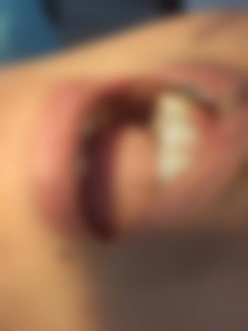 八、重庆市万州区皓牙口腔怎么预约?