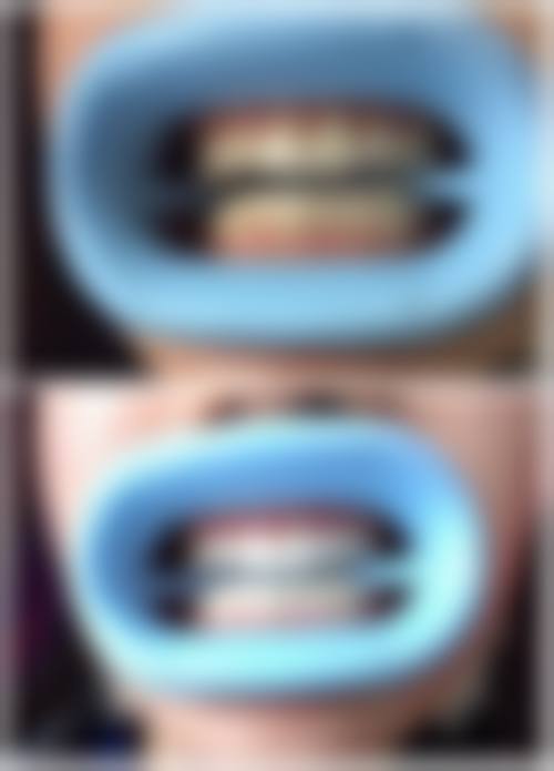 八、蜗牛口腔诊所怎么预约？