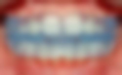 七、四川宜宾喜牙口腔医院地址电话及营业时间