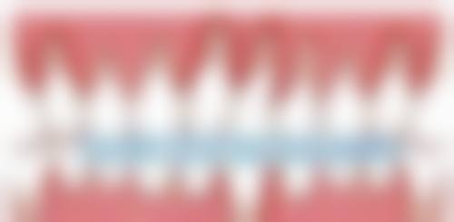 控制血糖是关键