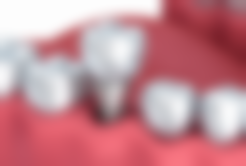 五、金坛卡西瓦口腔门诊部收费价格表