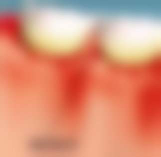 张维琳医生口碑评价及真人实例反馈