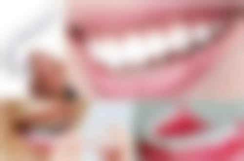 补牙像石膏一样的东西掉了怎么办？立即就诊，避免刺激，还需保持口腔清洁来应对！ 