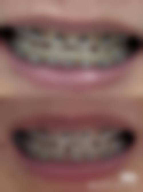 七、浙江金华永康阳光口腔地址电话及营业时间