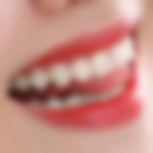 四、太原小兵口腔门诊部特色项目