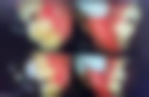 四、广州益德口腔特色项目