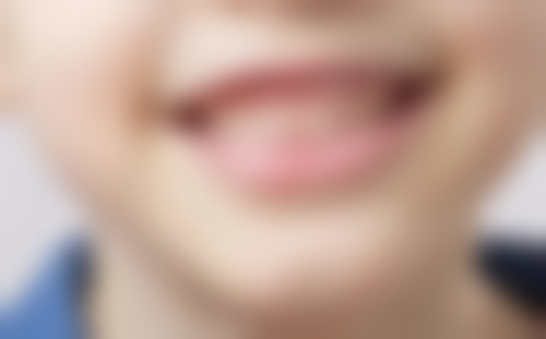 六、北京佳美口腔杜岩医生口碑评价及真人实例反馈