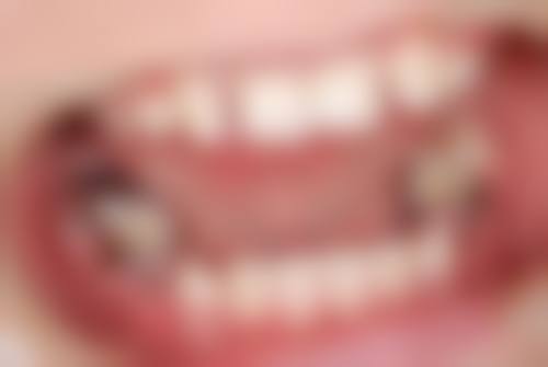 六、南京博韵口腔严玲医生口碑评价及真人实例反馈