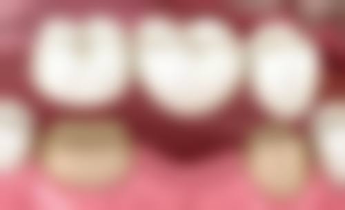 四、长沙市口腔医院口腔修复科特色项目