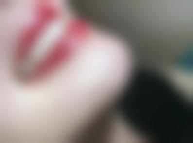 门牙四颗做全瓷牙连冠好吗？好坏皆有，需结合牙体条件、功能及美观需求综合评估！ 