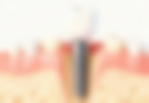 六、德阳口腔程翔医生口碑评价及真人实例反馈