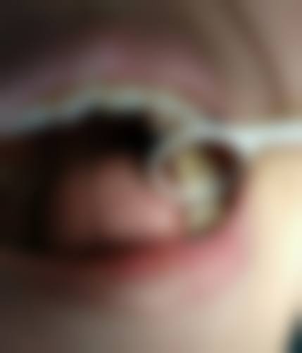 五、深圳精中诚口腔诊所收费价格表