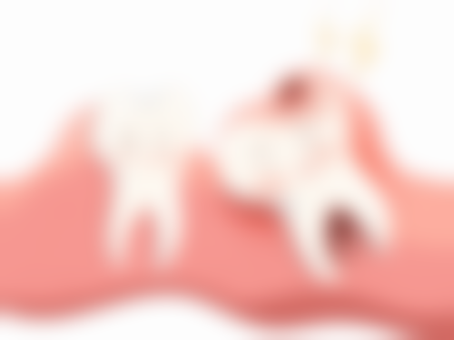 拔牙多久才可以漱口？一般24小时后为宜，还需注意漱口方式及其他相关护理要点！ 