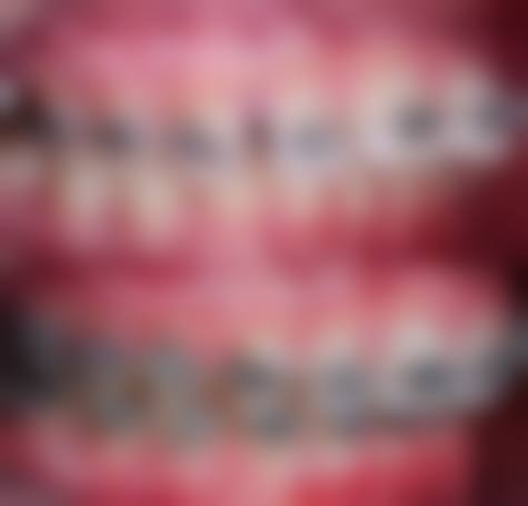 五、郴州明皓口腔收费价格表