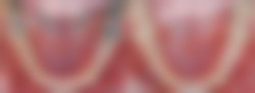 六、延安黄陵亨盛口腔门诊部口碑如何？