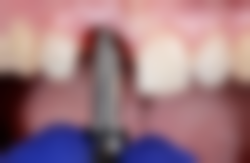 八、江苏盐城熊安富口腔门诊部怎么预约？